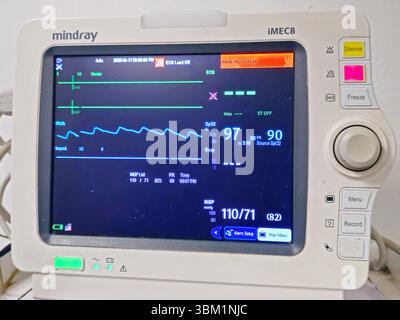 Le Caire, Égypte, 17 juin 2025 : moniteur médical des signes vitaux pour la mesure des signes vitaux importants pour les patients, comme la pression artérielle, le rat cardiaque Banque D'Images