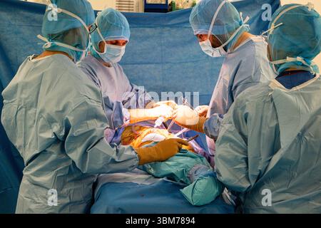 Mise en place d'une prothèse de hanche avec assistance robotique à l'hôpital Lyon Sud. Banque D'Images