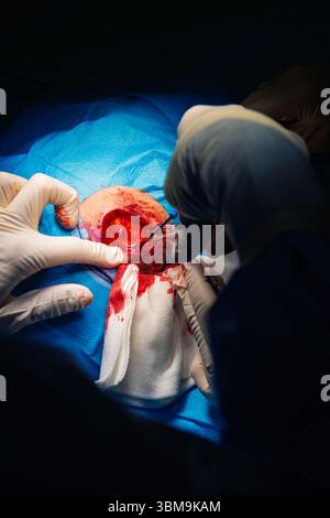 Chirurgie dermatologique au bloc opératoire. Coagulation des vaisseaux sanguins de la plaie chirurgicale. Carcinome épidermoïde. Les mains d'un chirurgien et salut Banque D'Images