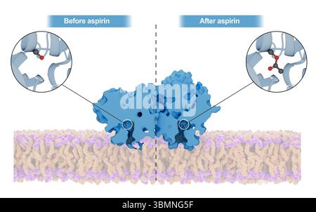 Illustration du mécanisme d'action de l'aspirine au sein de l'enzyme cyclooxygénase (COX). L'aspirine acétyle un résidu sérine clé de la COX, conduisant à un changement structurel irréversible du site actif de la COX qui l'empêche d'agir sur l'acide arachidonique pour produire des réponses inflammatoires. Banque D'Images