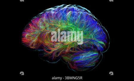 Illustration d'un tractogramme cérébral à haute résolution, représentant le réseau complexe de voies neuronales dans le cerveau humain. Les faisceaux de fibres complexes sont visualisés à l'aide de l'imagerie de tenseur de diffusion avancée (DTI), fournissant des informations sur la connectivité et la structure de la substance blanche du cerveau. Banque D'Images