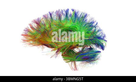 Illustration d'un tractogramme cérébral à haute résolution, représentant le réseau complexe de voies neuronales dans le cerveau humain. Les faisceaux de fibres complexes sont visualisés à l'aide de l'imagerie de tenseur de diffusion avancée (DTI), fournissant des informations sur la connectivité et la structure de la substance blanche du cerveau. Banque D'Images