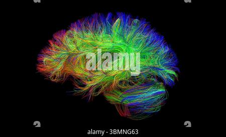 Illustration d'un tractogramme cérébral à haute résolution, représentant le réseau complexe de voies neuronales dans le cerveau humain. Les faisceaux de fibres complexes sont visualisés à l'aide de l'imagerie de tenseur de diffusion avancée (DTI), fournissant des informations sur la connectivité et la structure de la substance blanche du cerveau. Banque D'Images
