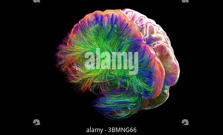 Illustration d'un tractogramme cérébral à haute résolution, représentant le réseau complexe de voies neuronales dans le cerveau humain. Les faisceaux de fibres complexes sont visualisés à l'aide de l'imagerie de tenseur de diffusion avancée (DTI), fournissant des informations sur la connectivité et la structure de la substance blanche du cerveau. Banque D'Images