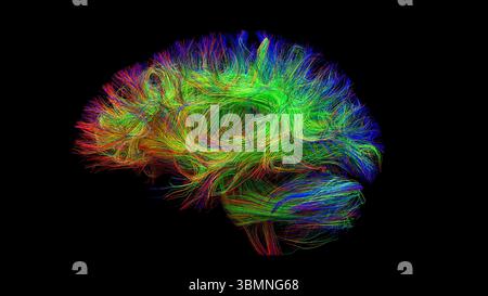 Illustration d'un tractogramme cérébral à haute résolution, représentant le réseau complexe de voies neuronales dans le cerveau humain. Les faisceaux de fibres complexes sont visualisés à l'aide de l'imagerie de tenseur de diffusion avancée (DTI), fournissant des informations sur la connectivité et la structure de la substance blanche du cerveau. Banque D'Images