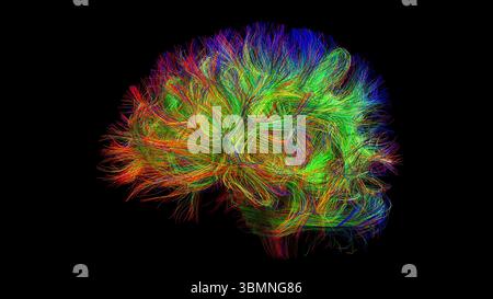 Illustration d'un tractogramme cérébral à haute résolution, représentant le réseau complexe de voies neuronales dans le cerveau humain. Les faisceaux de fibres complexes sont visualisés à l'aide de l'imagerie de tenseur de diffusion avancée (DTI), fournissant des informations sur la connectivité et la structure de la substance blanche du cerveau. Banque D'Images
