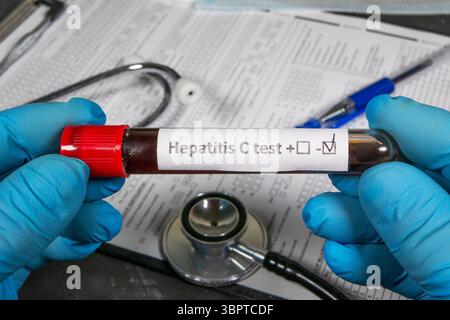 Mains gantées tenant un tube à essai indiquant un résultat négatif pour l'hépatite c avec un stéthoscope et des formes médicales en arrière-plan Banque D'Images