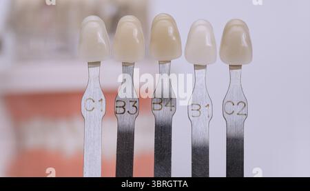 Gros plan d'un guide de teinte dentaire avec des échantillons dentaires étiquetés utilisés pour sélectionner la bonne couleur en dentisterie esthétique. Banque D'Images