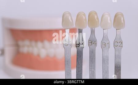 Gros plan d'un guide de teinte dentaire avec des échantillons dentaires étiquetés utilisés pour sélectionner la bonne couleur en dentisterie esthétique. Banque D'Images