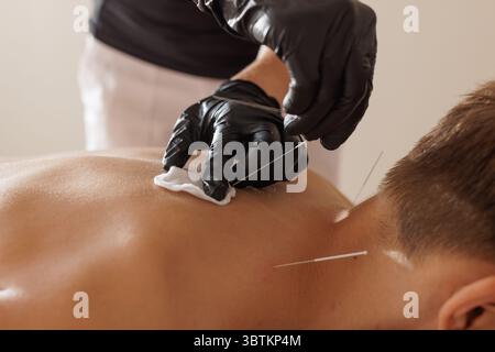 Thérapeute professionnel exécutant la technique d'aiguilletage à sec pour le soulagement de la douleur musculaire et la réhabilitation des blessures Banque D'Images