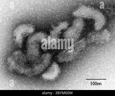 23 juin 2023, TOKYO, TOKYO, Japon : Tokyo (Japon), 23/06/2023.- une photo non datée mise à disposition par l'Institut national des maladies infectieuses (NIID) montre une micrographie électronique du virus Oz (publiée le 23 juin 2023). Le ministère japonais Äôs de la santé, du travail et de la protection sociale a confirmé le 23 juin 2023 qu'une femme de 70 ans décédée d'une myocardite au début de l'été 2022 avait reçu un diagnostic d'infection causée par le virus Oz, qui serait transmis par des tiques. C'est le premier rapport d'infection par le virus Oz et de décès chez un humain. (Japón) (crédit image : © Institut national des maladies infectieuses Banque D'Images