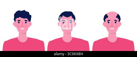 Les stades de la perte de cheveux. Types de calvitie sur vecteur de tête masculine. Illustration de Vecteur