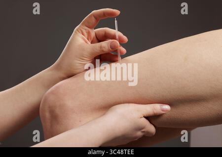 Technique professionnelle d'aiguilletage à sec pour le soulagement de la douleur musculaire, la thérapie de point de déclenchement et la réhabilitation des blessures sportives Banque D'Images