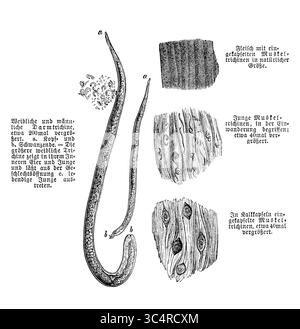 Parasites : vers trichines ou vers ronds ou trichinella (ici 200 fois amplifiés) vivant comme parasites intracellulaires des animaux et des humains, gravure du XIXe siècle Banque D'Images