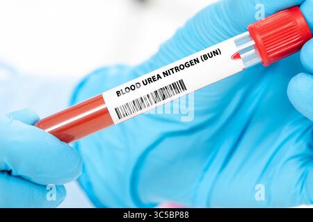 L'azote uréique sanguin (BUN) évalue la fonction rénale en mesurant la quantité d'azote dans le sang qui provient de l'urée. Banque D'Images