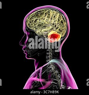 Illustration du cerveau humain avec cervelet mis en évidence. Il est responsable de la coordination, de l'équilibre et du contrôle fin du moteur. Les dommages au cervelet sont fréquents dans l'ataxie et les troubles neurodégénératifs. Banque D'Images