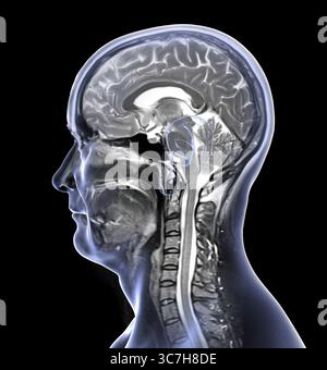 Illustration d’une imagerie par résonance magnétique (IRM) colorée du cerveau et du cou, montrant l’anatomie du système nerveux central et la colonne cervicale. Banque D'Images