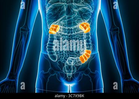 Vue radiographique antérieure ou frontale des flexions du côlon humain en rendu 3D avec contours du corps masculin. Anatomie, organe du système digestif, Med Banque D'Images