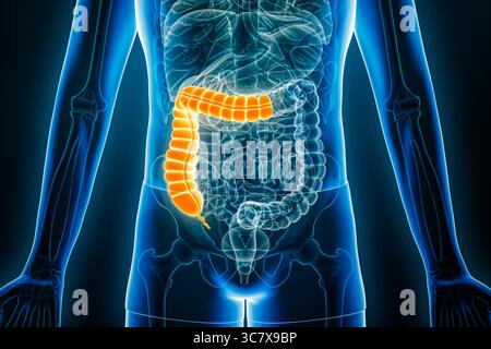 Vue radiographique antérieure ou frontale du côlon proximal ou droit, illustration de rendu 3D avec contours corporels. Anatomie humaine, organe du syst digestif Banque D'Images