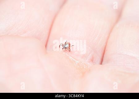 Tique (Icodes ricinus) rampant sur la main humaine Banque D'Images