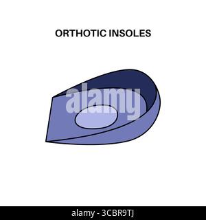 Illustration de semelles orthétiques. Ce sont des inserts de chaussures conçus pour soutenir, amortir et corriger les problèmes de pied et de cheville tels que les éperons de talon ou la fasciite plantaire. Banque D'Images