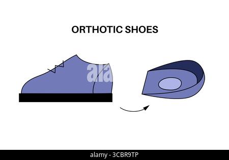 Illustration de semelles orthétiques. Ce sont des inserts de chaussures conçus pour soutenir, amortir et corriger les problèmes de pied et de cheville tels que les éperons de talon ou la fasciite plantaire. Banque D'Images