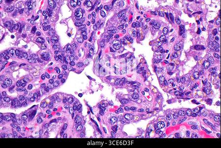 Micrographie à la lumière de l'épithélium vésiculaire séminal. L'épithélium est constitué des cellules de revêtement dans les glandes de la vésicule séminale. L'épithélium des vésicules séminales se caractérise par des cellules rondes et parfois agrandies (structures bleues rondes), ainsi que par un pigment de lipofuscine (jaune). La vésicule séminale sécrète des substances dans sa lumière (zones blanches de l'image). Coupe de tissu colorée à l'hématoxyline et à l'éosine. Grossissement : 400x lorsqu'il est imprimé à 10cm. Banque D'Images