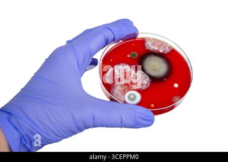Colonies de champignons de moisissure cultivées à partir de l'air intérieur sur gélose Blood Sheep, photographie montrant la diversité microbienne et la contamination de l'air. Banque D'Images