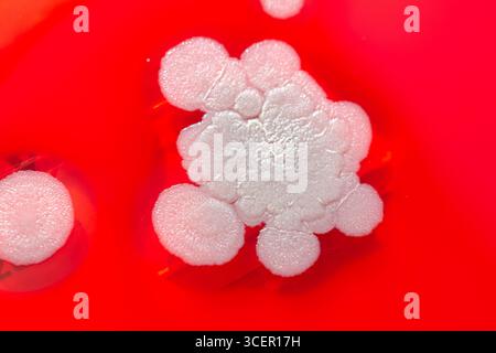 Colonies de champignons de moisissure cultivées à partir de l'air intérieur sur gélose Blood Sheep, photographie montrant la diversité microbienne et la contamination de l'air. Banque D'Images