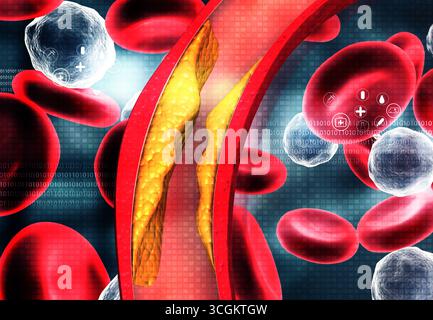 Artère bloquée par le cholestérol sur fond médical. illustration 3d. Banque D'Images