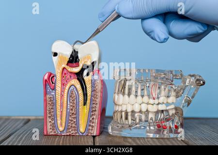 Gros plan d'un modèle de carie dentaire anatomique examiné avec un explorateur dentaire à côté d'un modèle de mâchoire complète transparent sur une surface en bois. Banque D'Images