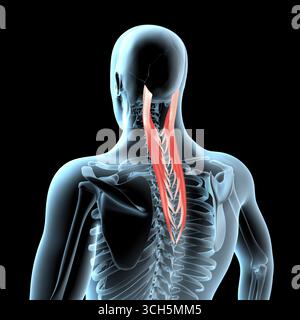 Cette illustration 3d montre la position anatomique des muscles supérieurs de la splénus capitis sur le corps de radiographie Banque D'Images