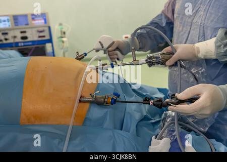 Chirurgien bariatrique pratiquant un manchon gastrique pour traiter l'obésité, gros plan des mains et instruments chirurgicaux. Banque D'Images