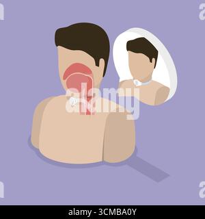 Illustration plate isométrique 3D de trachéotomie, chirurgie trachéale Banque D'Images