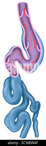 Illustration montrant des varices, une condition qui dilate et déforme les veines en raison d'un dysfonctionnement des valves veineuses. Ils apparaissent généralement dans les jambes et peuvent causer des symptômes tels que douleur, gonflement et sensation de lourdeur. Leur origine peut être liée à des facteurs génétiques, à un mode de vie sédentaire ou à des périodes prolongées de repos. Banque D'Images
