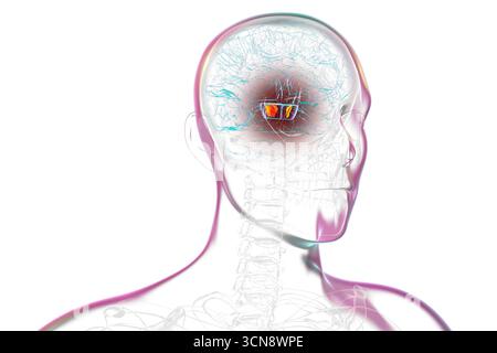 Illustration d'un cerveau humain avec la substantia nigra mise en évidence dans le mésencéphale, une structure clé impliquée dans la régulation du mouvement et affectée dans la maladie de Parkinson. Banque D'Images