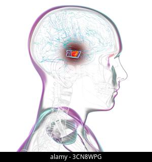 Illustration d'un cerveau humain avec la substantia nigra mise en évidence dans le mésencéphale, une structure clé impliquée dans la régulation du mouvement et affectée dans la maladie de Parkinson. Banque D'Images