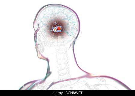 Illustration d'un cerveau humain avec la substantia nigra mise en évidence dans le mésencéphale, une structure clé impliquée dans la régulation du mouvement et affectée dans la maladie de Parkinson. Banque D'Images