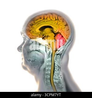 Illustration d’une imagerie par résonance magnétique (IRM) colorée du cerveau et du cou, montrant l’anatomie du système nerveux central et la colonne cervicale. Banque D'Images