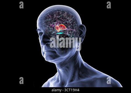 Illustration du cerveau humain d'une personne âgée avec thalamus en surbrillance (rouge), montrant les structures appariées de la matière grise profonde qui relaient les signaux sensoriels et moteurs au cortex cérébral. Banque D'Images