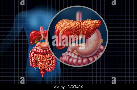 Stéatose hépatique et stéatose hépatique partie du corps comme un concept de soins de santé médical de l'anatomie du système digestif et organe vital pour le plaisir de la digestion Banque D'Images