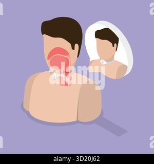 Illustration plate isométrique 3D de trachéotomie, chirurgie trachéale 3D illustration plate isométrique de trachéotomie, surtension trachéale Banque D'Images