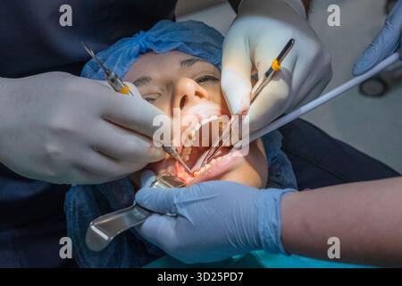 Le médecin travaille sur la bouche largement ouverte du patient à l'aide de l'outil d'aspiration pendant la procédure. Femme mâchoire fixe stable permettant un accès clair pour le traitement dentaire. Photo de haute qualité Banque D'Images