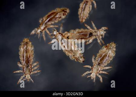 Poux de tête. Ectoparasite de sucer le sang humain. Les poux de tête. Banque D'Images