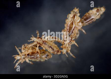 Poux de tête. Ectoparasite de sucer le sang humain. Les poux de tête. Banque D'Images