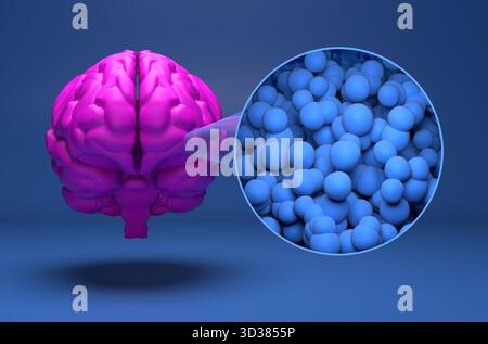 Glioblastome multiforme - vue isométrique illustration 3D. Banque D'Images