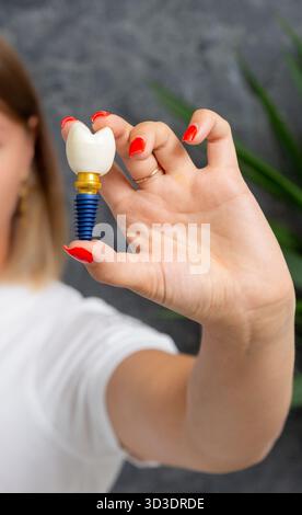 Une personne détient un modèle d'implant dentaire, avec une couronne dentaire blanche et une vis bleue, mettant en évidence les prothèses dentaires modernes et le con de santé bucco-dentaire Banque D'Images