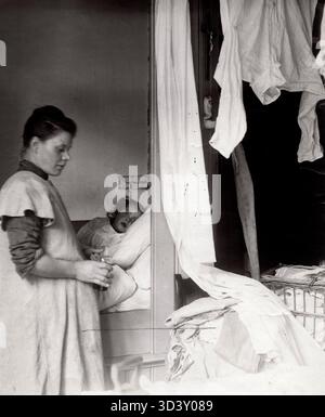Un enfant atteint de scarlatine est représenté dans une chambre d'hôpital entourée de draps humides. Cette image de 1921 souligne l’importance de l’hygiène dans la prévention des maladies infectieuses au début du XXe siècle. Banque D'Images