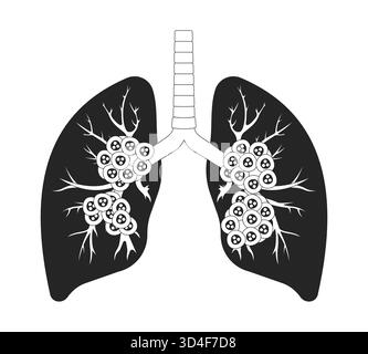 Poumons humains affectés par un cancer à un stade avancé illustration Illustration de Vecteur