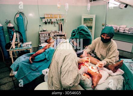 À Kaboul, en 1992, des chirurgiens de l'hôpital du CICR opèrent sur une victime de mines terrestres dans une salle d'opération. Banque D'Images